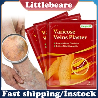 littlebeare.co 6Pcs/Set Veins Ointmnet Easy to Absorb Repair Swelling Natural Extract Varicose Vasculitis Phlebitis Spider Cream Plaster for Adult