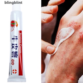 [bling] 25g herbal antibacteriano crema psoriasis crema anti-itch alivio eczema piel erupción