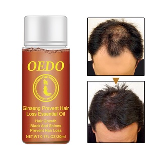 [fx] 20ml ginseng esencia de crecimiento del cabello anti pérdida rápida restauración densa suero líquido