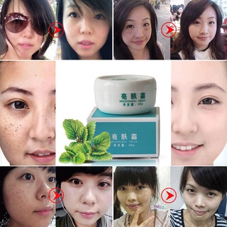 【Chiron】Face Skin Care Pigment Freckles Pregnancy Acne Spot Remove Cream 40g Whitening