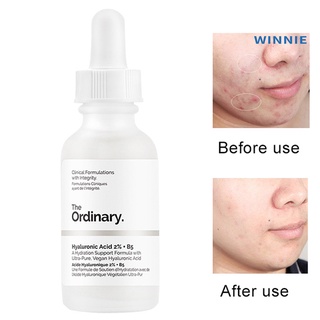 [winnie] blanqueamiento retráctil poros piel facial ácido hialurónico b5 esencia sueros líquido