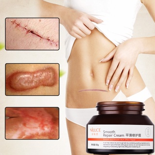 【Chiron】Scar Removal Cream Stretch Marks Relief and Burns Repair Acne Mark Removal Cream