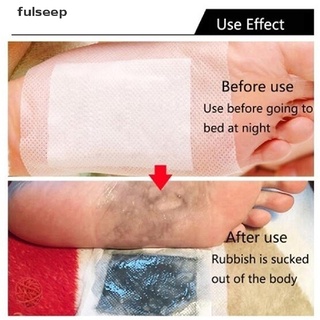 [fulseep] 10 piezas de desintoxicación parche de pies máscara mejorar sueño adelgazar cuidado de los pies pegatinas peso sdgc (2)