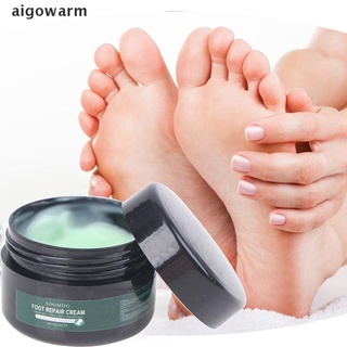 aigowarm 15g masaje de pies exfoliante crema exfoliante piel blanqueamiento pies crema hidratante co