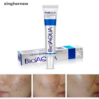 [xinghernew] cicatriz para el cuidado de la piel facial/acné/retráctil/eliminar el control de aceite/crema facial hidratante