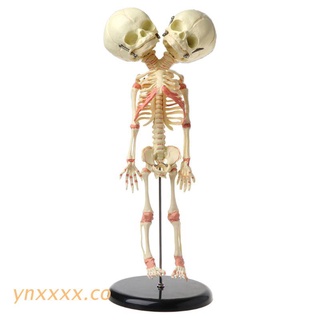 ynxxxx 37cm Human Double Head Baby Skull Skeleton Anatomy Brain Display Study Teaching Anatomical Model