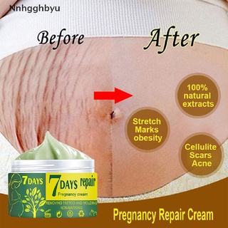 [nnhgghbyu] maternidad reparación de la piel suave crema de la piel para las estrías cuidado de eliminación de cicatrices venta caliente