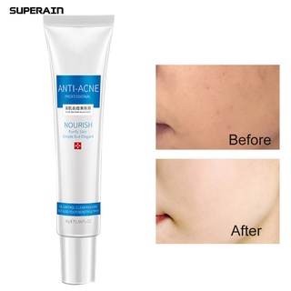 [bodycare] 3pcs acné comedo eliminación de poros retráctiles control de aceite hidratante cuidado de la piel crema (1)