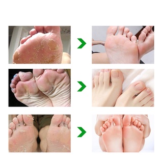 Exfoliating Foot Peel Mask Moisturizing Socks Aloe Vera for Repair Skin (5)
