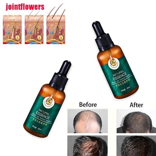 JTCO Hair Growth Products For Men Women Natural Ginger Oil Serum Grow Fast Treatment JTT