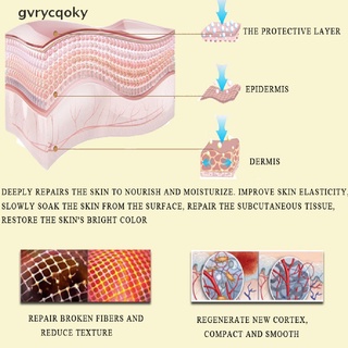 [gvrycqoky] 1pc eliminar cicatrices de embarazo crema de reparación de la piel rosa eliminar estrías crema (3)