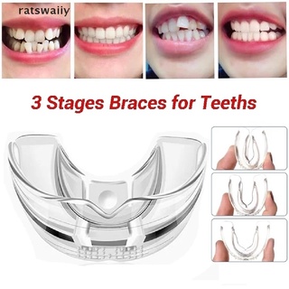 Ratswaiiy Orthodontic Braces Appliance Dental Braces Bruxism MouthGuard Teeth Straightener CO