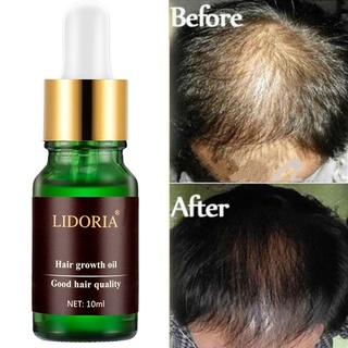 alotoforders11.co 10ml Hair Growth Essential Oil Anti Drying Nourishing Repairing Scalp Treatment (2)