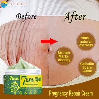wiley0123 Pregnancy Repair Cream Stretch Marks Treatment Repair Anti-winkles Firming Body Cream