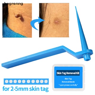 begrenng tag band removedor de etiquetas de piel kit no tóxico cuidado facial mole verruga bandas de goma conjunto co