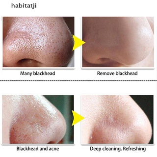 [habi] esencia de aceite de árbol de té limpieza de poros nasales eliminar aceite cabeza negra parche de espinillas.