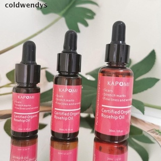 [coldwendys] aceite de rosa mosqueta certificado de piel orgánica aceite esencial puro y natural mejor aceite facial