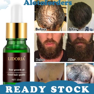 alotoforders11.co 10ml Hair Growth Essential Oil Anti Drying Nourishing Repairing Scalp Treatment