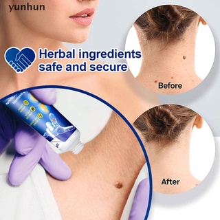 yunhun Sumifun 20g Warts Remover Ointment Wart Treatment Cream Skin Tag Remover Herbal .
