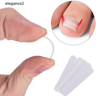 [elegance2] 10 pegatinas de corrección de uñas encarnadas para pies, pedicura, corrector de uñas [elegance2]