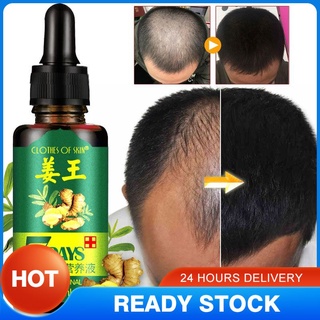 In Stock 30ML Effective Hair Growth Ointment Hair Care Healthy Hair Growth Essence Oil Blackpink