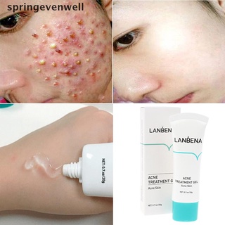 Evenwell Acne Treatment Whitening Cream Blackhead Repair Gel Oil Control Shrink Pore Scar New Stock (1)