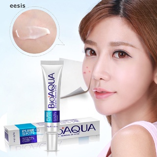 [Eesis] Face Skin Care Acne Shrink Pore Scar Remove Oil Control Moisturizing Face Cream FGH