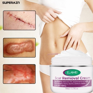 superain 50ml crema cicatrizante fácil de absorber cicatrices de marchita cuidado de la piel cicatrizante piel estiramiento tratamiento para parte del cuerpo