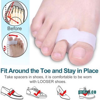 <hot*~pu>2 piezas separador de pies de silicona para pies hallux valgus corrector de pies alivio del dolor
