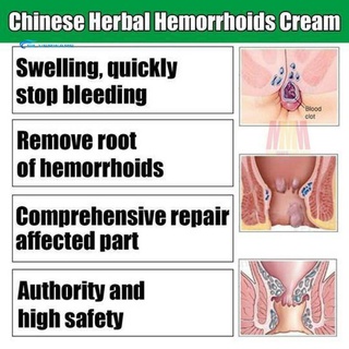stock crema antibacteriana chino herbal hemorroides ungüento anti-inflamatorio gel (2)