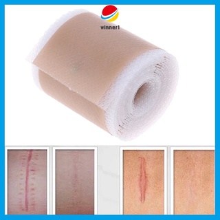 Efficient Beauty Scar Removal Silicone Gel Self-Adhesive Silicone Gel Tape Patch for Acne Burn Scar Reduce