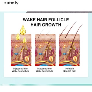 [zuym] spray líquido anti pérdida de cabello para mujeres hombres rebrote reparación tratamiento suero xvd