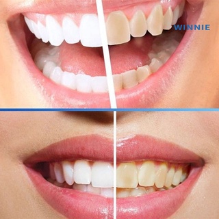 [winnie] removedor de manchas de polvo de blanqueamiento de dientes naturales higiene oral limpieza dental cuidado dental (6)