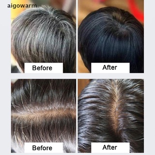 aigowarm organic hair darkening jabón champú hidratante reparación polygonum multiflorum jabón co (5)