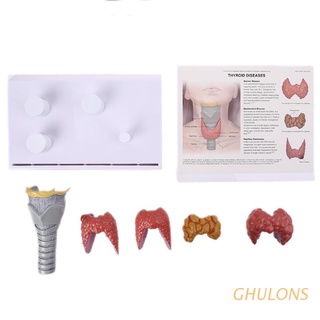 ghulons humano anatómico glándula tiroides modelo patología anatomía sistema digestivo estudio herramienta de enseñanza