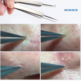 [winnie] pinzas de acero inoxidable curvadas de espinillas removedor de acné pinzas herramienta de aguja (7)