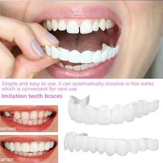 Smart Smile Father's Day Special Temporary Fake Teeth Socket-Perfect Braces For Covering Broken Teeth