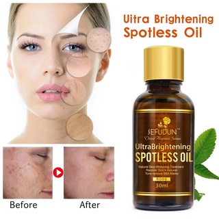 【Chiron】Whitening Rose Whitening Facial Moisturizing Skin Care Massage Essential Oil