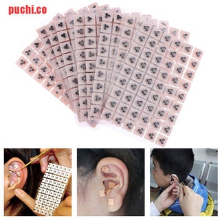 [puchi] 540 pzs semillas de prensa de oreja desechables grandes acupuntura Vaccaria Pla