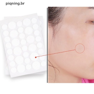 Pizarrón adhesivo Removedor De acné con espinillas/herramienta Para absorber aceite y acné