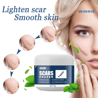 [winnie] 30g cicatriz crema compresa fría multiusos reparación estrías sintética acné estiramiento crema de pigmentación (4)