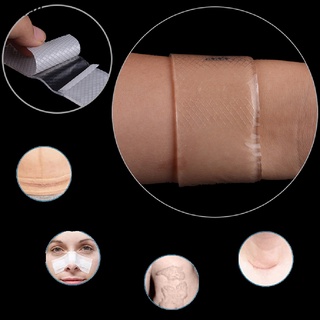 valley scar therapy eliminar trauma burn silicon patch reutilizable acné gel reparación de la piel nuevo co