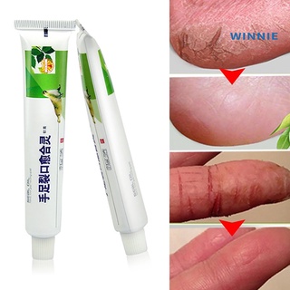 [winnie] potente pie de mano crema de grietas talón agrietado peeling cuidado de la piel ungüento chino (1)