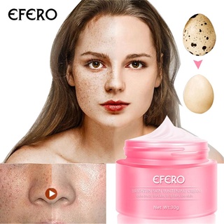 【Chiron】2PC Dark Spots Corrective Freckle Cream Moisturizing Firming Facial Cream (1)