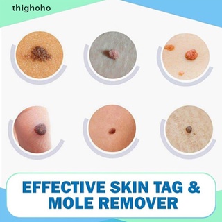 Thighoho 3ml Treatment Papillomas Removal Of Warts Liquid From Skin Tags Removing CO