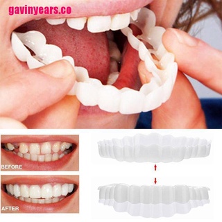 [GAV&CO] 1 juego de dientes dentales falsos para blanquear dientes cómodos dentales cubierta de dientes