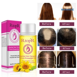 [winnie] 20 ml potente esencia de crecimiento de cabello herbal líquido anti-pérdida de cabello aceite esencial