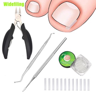 [M] Corrección de uñas de pie/herramienta de pedicura para uñas/tratamiento de paroniquia/cuidado de los pies