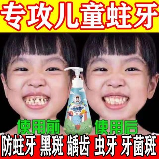 Probiótico niños pasta de dientes anti caries dientes de 3 a 12 años de edad niños anti caries sabor fruta grado alimenticio puede ser