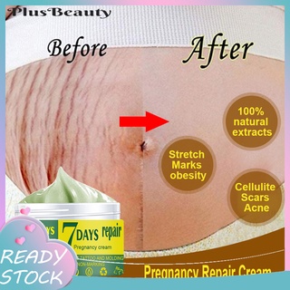 pluscloth1.co crema de reparación de embarazo eliminación de estiramiento fácil de absorber extractos naturales de la piel de la cicatriz eliminar crema para la madre
